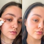 Skin Concerns
